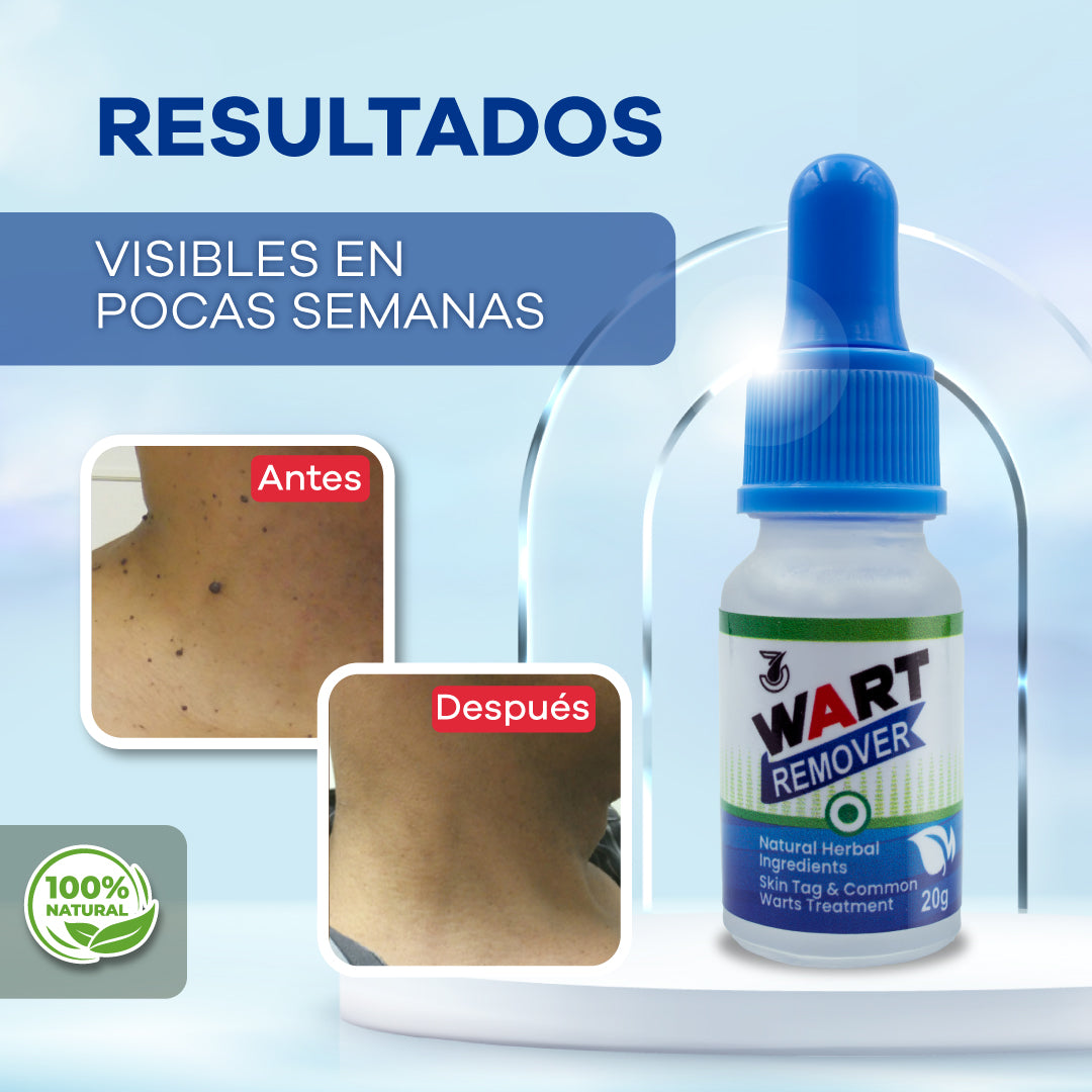 WART REMOVER™ - Elimina Verrugas y Lunares en la piel